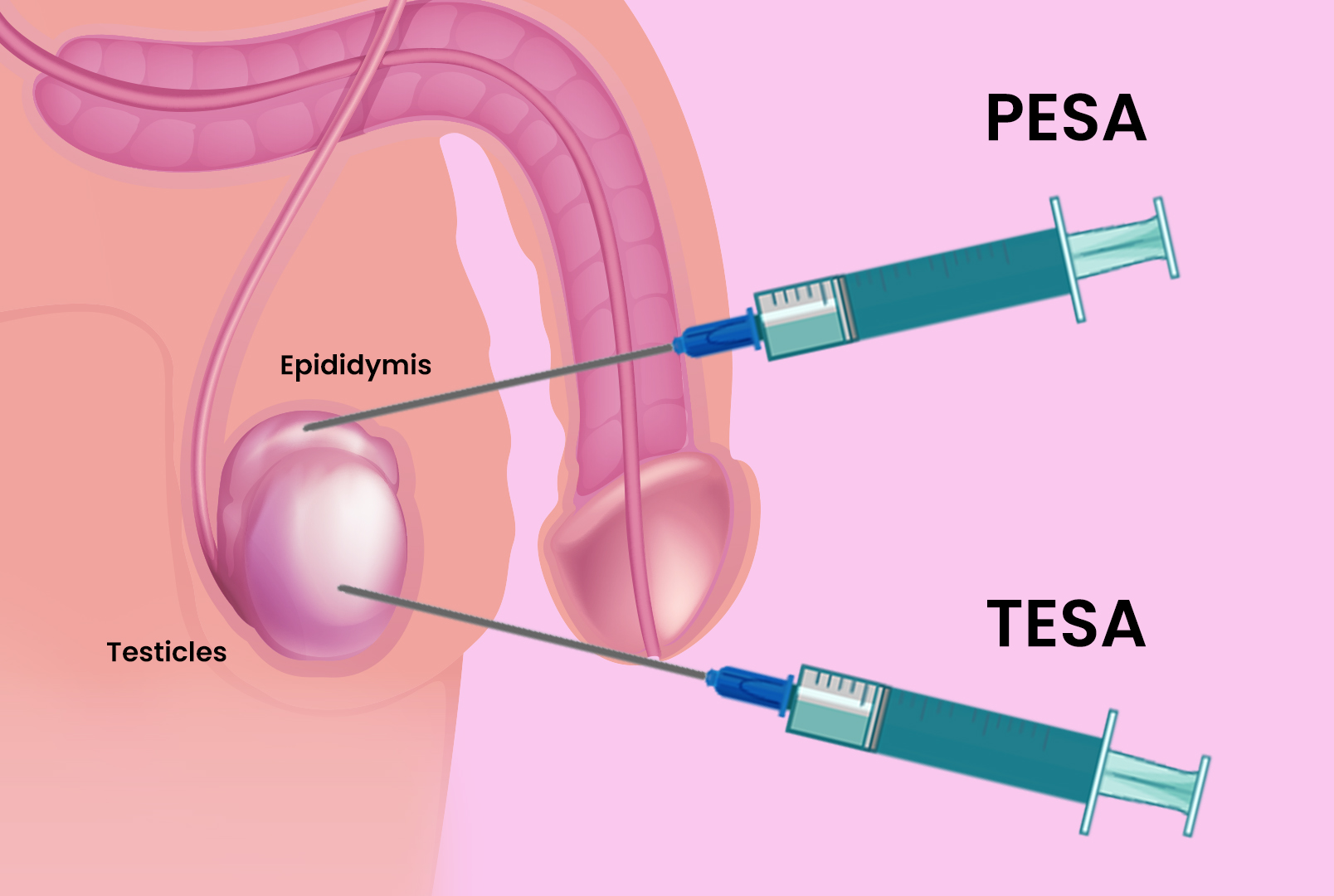 Tesa shreshta fertility centre